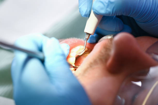 Best Emergency Dental Filling Replacement  in La Center, WA